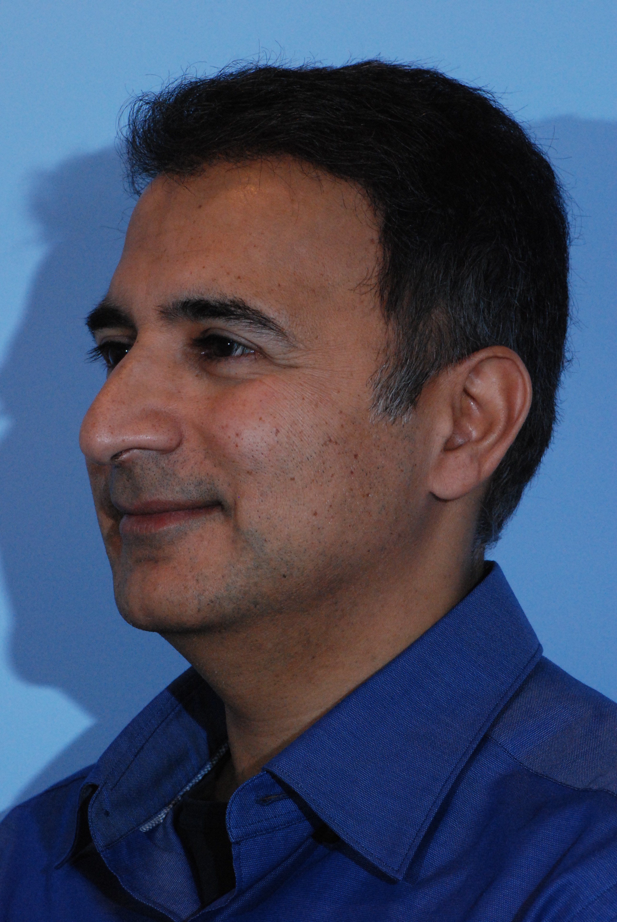 Male Rhinoplasty Before