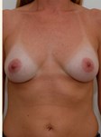 After Image