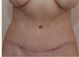 After Image