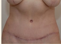 After Image