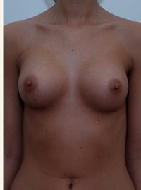 After Image