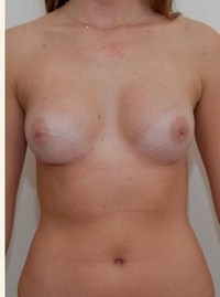 After Image