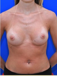 After Image