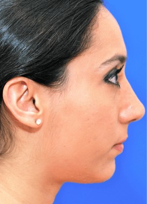 Right profile view After