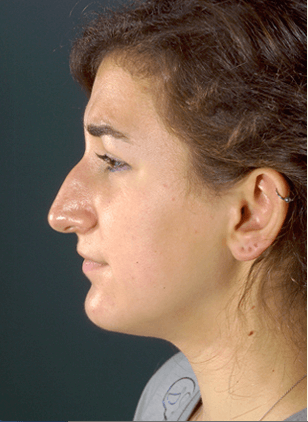 Before Image