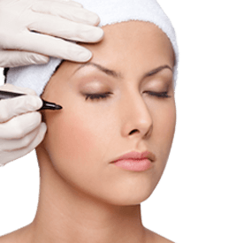 Eyelid Surgery Image