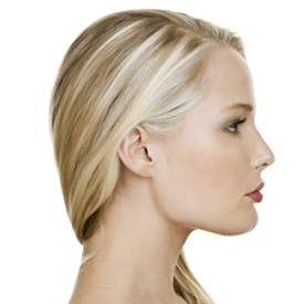 Rhinoplasty Image